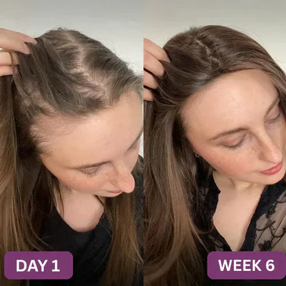 Hair Growth Gummies